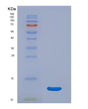 SDS-PAGE analysis of Human CDK2 (Cyclin-Dependent Kinase 2) - Recombinant Protein, showing >95% purity under 15% SDS-PAGE (Reduced)
