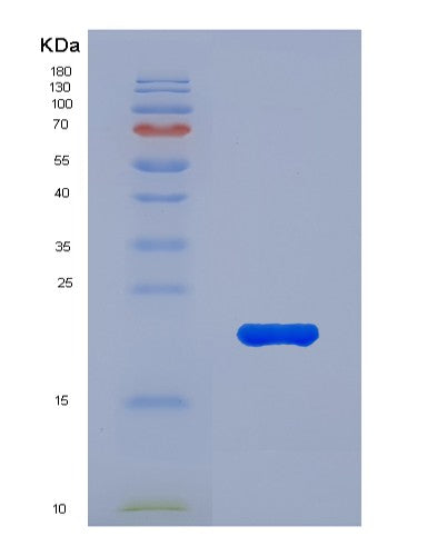 SDS-PAGE analysis of Mouse Il1rn (Interleukin-1 Receptor Antagonist Protein) - Recombinant Protein, showing >95% purity under 15% SDS-PAGE (Reduced)