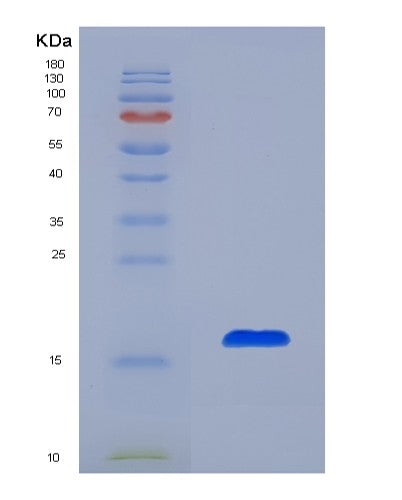 SDS-PAGE analysis of Human AZGP1 (Zinc-Alpha-2-Glycoprotein) - Recombinant Protein, showing >85% purity under 15% SDS-PAGE (Reduced)
