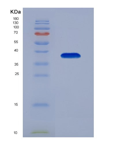 SDS-PAGE analysis of Human DNAJB1 (Dnaj Homolog Subfamily B Member 1) - Recombinant Protein, showing >95% purity under 15% SDS-PAGE (Reduced)