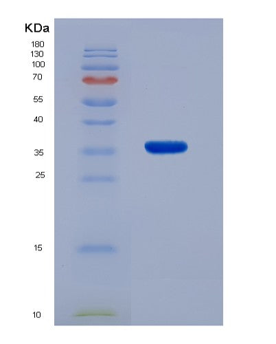 SDS-PAGE analysis of Human DNAJB2 (Dnaj Homolog Subfamily B Member 2) - Recombinant Protein, showing >90% purity under 15% SDS-PAGE (Reduced)