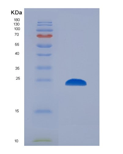 SDS-PAGE analysis of Human CTSS (Cathepsin S) - Recombinant Protein, showing >95% purity under 15% SDS-PAGE (Reduced)
