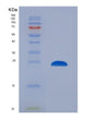 SDS-PAGE analysis of Human CTSS (Cathepsin S) - Recombinant Protein, showing >95% purity under 15% SDS-PAGE (Reduced)