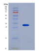 SDS-PAGE analysis of Human CTNNA1 (Catenin Alpha-1) - Recombinant Protein, showing >90% purity under 15% SDS-PAGE (Reduced)