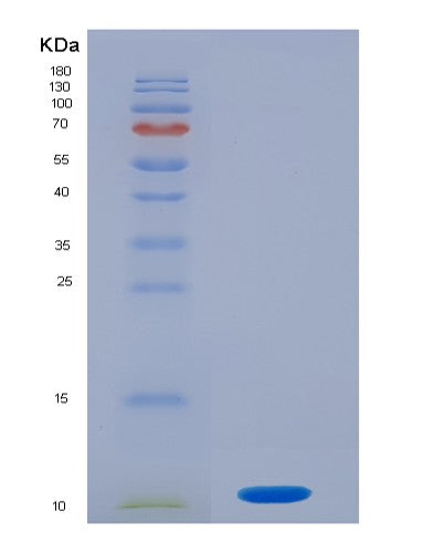 SDS-PAGE analysis of Human S100P (Protein S100-P) - Recombinant Protein, showing >95% purity under 15% SDS-PAGE (Reduced)