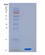 SDS-PAGE analysis of Human S100P (Protein S100-P) - Recombinant Protein, showing >95% purity under 15% SDS-PAGE (Reduced)