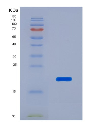 SDS-PAGE analysis of Human NFKBIA (Nf-Kappa-B Inhibitor Alpha) - Recombinant Protein, showing >95% purity under 15% SDS-PAGE (Reduced)
