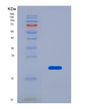SDS-PAGE analysis of Human NFKBIA (Nf-Kappa-B Inhibitor Alpha) - Recombinant Protein, showing >95% purity under 15% SDS-PAGE (Reduced)