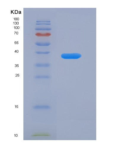 SDS-PAGE analysis of Human MSN (Moesin) - Recombinant Protein, showing >90% purity under 15% SDS-PAGE (Reduced)