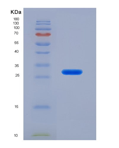 SDS-PAGE analysis of Human IVD (Isovaleryl-Coa Dehydrogenase, Mitochondrial) - Recombinant Protein, showing >90% purity under 15% SDS-PAGE (Reduced)