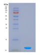 SDS-PAGE analysis of Human S100A4 (Protein S100-A4) - Recombinant Protein, showing >85% purity under 15% SDS-PAGE (Reduced)