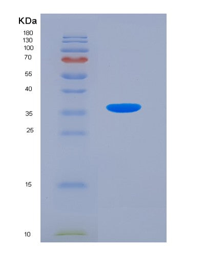 SDS-PAGE analysis of Human CASR (Extracellular Calcium-Sensing Receptor) - Recombinant Protein, showing >90% purity under 15% SDS-PAGE (Reduced)