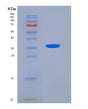 SDS-PAGE analysis of Human CASR (Extracellular Calcium-Sensing Receptor) - Recombinant Protein, showing >90% purity under 15% SDS-PAGE (Reduced)