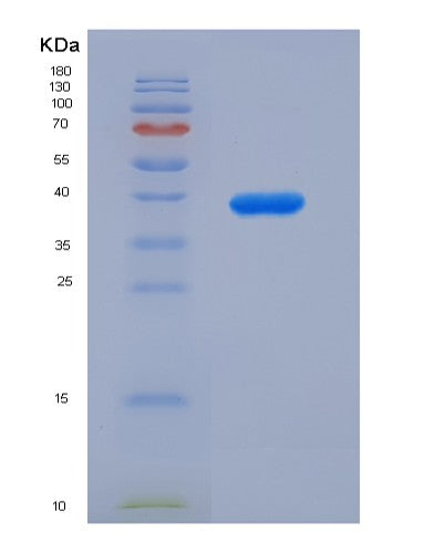 SDS-PAGE analysis of Human TARS1 (Threonine--Trna Ligase 1, Cytoplasmic) - Recombinant Protein, showing >85% purity under 15% SDS-PAGE (Reduced)