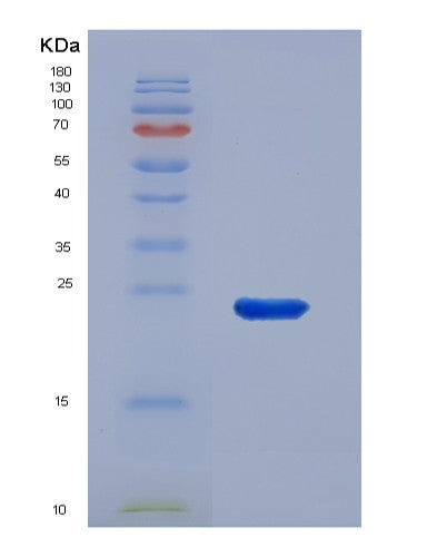 SDS-PAGE analysis of Human POLE3 (Dna Polymerase Epsilon Subunit 3) - Recombinant Protein, showing >85% purity under 15% SDS-PAGE (Reduced)