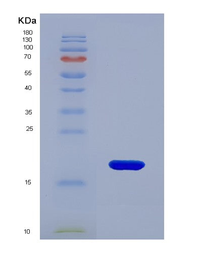 SDS-PAGE analysis of Human FKBP2 (Peptidyl-Prolyl Cis-Trans Isomerase Fkbp2) - Recombinant Protein, showing >85% purity under 15% SDS-PAGE (Reduced)