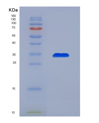 SDS-PAGE analysis of Human CCL7 (C-C Motif Chemokine 7) - Recombinant Protein, showing >90% purity under 15% SDS-PAGE (Reduced)