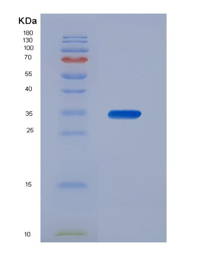 SDS-PAGE analysis of Human ANXA13 (Annexin A13) - Recombinant Protein, showing >95% purity under 15% SDS-PAGE (Reduced)