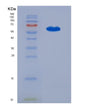 SDS-PAGE analysis of Human CALR (Calreticulin) - Recombinant Protein, showing >95% purity under 15% SDS-PAGE (Reduced)