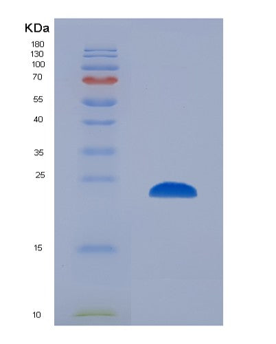 SDS-PAGE analysis of Human PSMB8 (Proteasome Subunit Beta Type-8) - Recombinant Protein, showing >85% purity under 15% SDS-PAGE (Reduced)