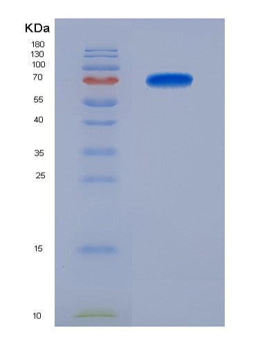 SDS-PAGE analysis of Human PREP (Prolyl Endopeptidase) - Recombinant Protein, showing >90% purity under 15% SDS-PAGE (Reduced)