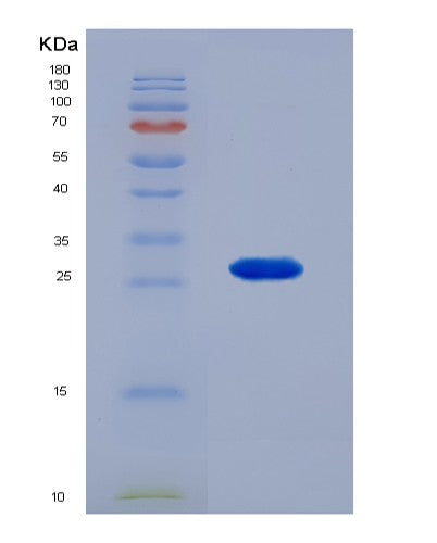 SDS-PAGE analysis of Human PSMB6 (Proteasome Subunit Beta Type-6) - Recombinant Protein, showing >95% purity under 15% SDS-PAGE (Reduced)