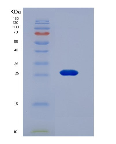 SDS-PAGE analysis of Human GSTM2 (Glutathione S-Transferase Mu 2) - Recombinant Protein, showing >95% purity under 15% SDS-PAGE (Reduced)