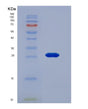 SDS-PAGE analysis of Human GSTM2 (Glutathione S-Transferase Mu 2) - Recombinant Protein, showing >95% purity under 15% SDS-PAGE (Reduced)