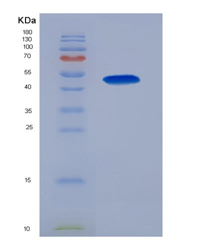SDS-PAGE analysis of Human LOX (Protein-Lysine 6-Oxidase) - Recombinant Protein, showing >85% purity under 15% SDS-PAGE (Reduced)