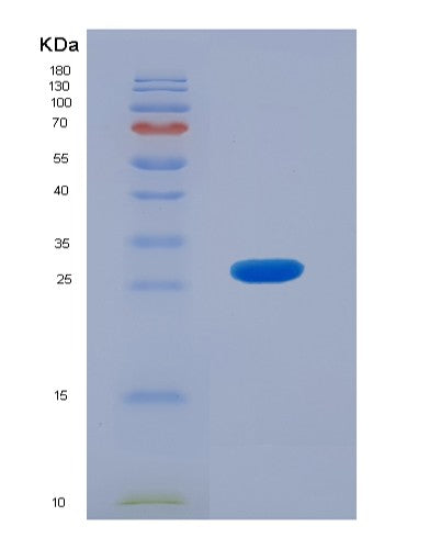 SDS-PAGE analysis of Human ACADL (Long-Chain Specific Acyl-Coa Dehydrogenase, Mitochondrial) - Recombinant Protein, showing >95% purity under 15% SDS-PAGE (Reduced)