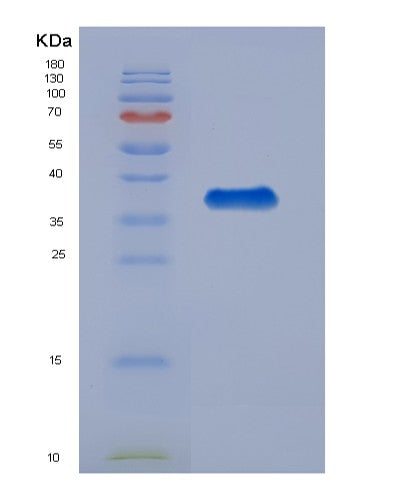 SDS-PAGE analysis of Human SHC1 (Shc-Transforming Protein 1) - Recombinant Protein, showing >95% purity under 15% SDS-PAGE (Reduced)