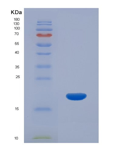 SDS-PAGE analysis of Human CRABP2 (Cellular Retinoic Acid-Binding Protein 2) - Recombinant Protein, showing >85% purity under 15% SDS-PAGE (Reduced)