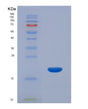 SDS-PAGE analysis of Human CRABP2 (Cellular Retinoic Acid-Binding Protein 2) - Recombinant Protein, showing >85% purity under 15% SDS-PAGE (Reduced)