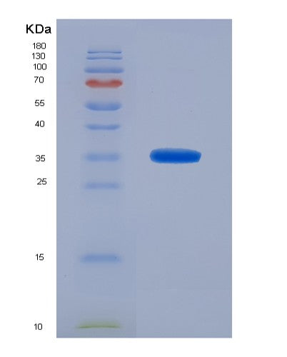 SDS-PAGE analysis of Human TKT (Transketolase) - Recombinant Protein, showing >95% purity under 15% SDS-PAGE (Reduced)
