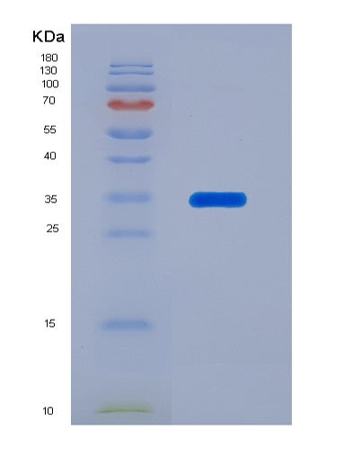SDS-PAGE analysis of Human SERPINA7 (Thyroxine-Binding Globulin) - Recombinant Protein, showing >90% purity under 15% SDS-PAGE (Reduced)