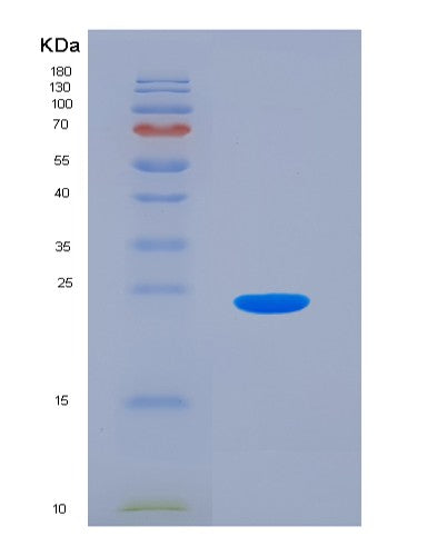 SDS-PAGE analysis of Mouse Selp (P-Selectin) - Recombinant Protein, showing >90% purity under 15% SDS-PAGE (Reduced)