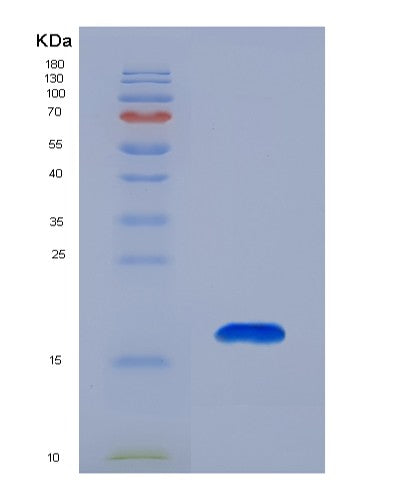 SDS-PAGE analysis of Human LAMA1 (Laminin Subunit Alpha-1) - Recombinant Protein, showing >90% purity under 15% SDS-PAGE (Reduced)