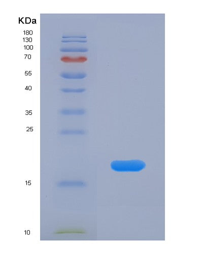 SDS-PAGE analysis of Human CRABP1 (Cellular Retinoic Acid-Binding Protein 1) - Recombinant Protein, showing >90% purity under 15% SDS-PAGE (Reduced)