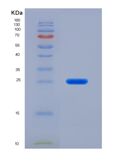 SDS-PAGE analysis of Human BLVRB (Flavin Reductase (Nadph)) - Recombinant Protein, showing >90% purity under 15% SDS-PAGE (Reduced)