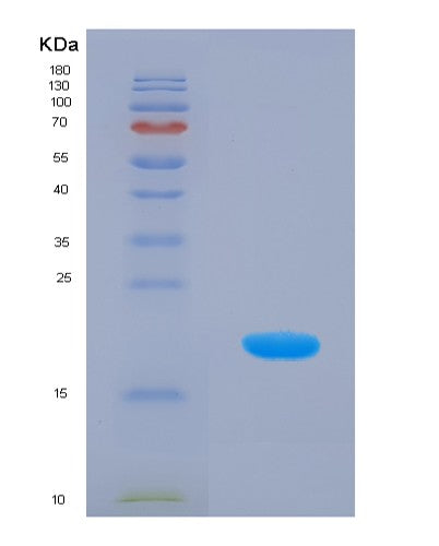 SDS-PAGE analysis of Human PRDX5 (Peroxiredoxin-5, Mitochondrial) - Recombinant Protein, showing >90% purity under 15% SDS-PAGE (Reduced)