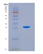 SDS-PAGE analysis of Human PRDX3 (Thioredoxin-Dependent Peroxide Reductase, Mitochondrial) - Recombinant Protein, showing >95% purity under 15% SDS-PAGE (Reduced)