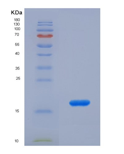 SDS-PAGE analysis of Human CASP2 (Caspase-2) - Recombinant Protein, showing >90% purity under 15% SDS-PAGE (Reduced)