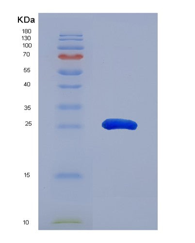 SDS-PAGE analysis of Human CCND2 (G1/S-Specific Cyclin-D2) - Recombinant Protein, showing >90% purity under 15% SDS-PAGE (Reduced)
