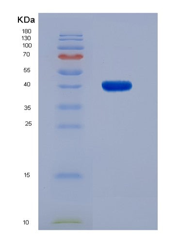 SDS-PAGE analysis of Human ADSL (Adenylosuccinate Lyase) - Recombinant Protein, showing >90% purity under 15% SDS-PAGE (Reduced)