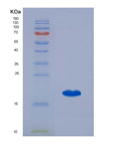 SDS-PAGE analysis of Human SRI (Sorcin) - Recombinant Protein, showing >95% purity under 15% SDS-PAGE (Reduced)