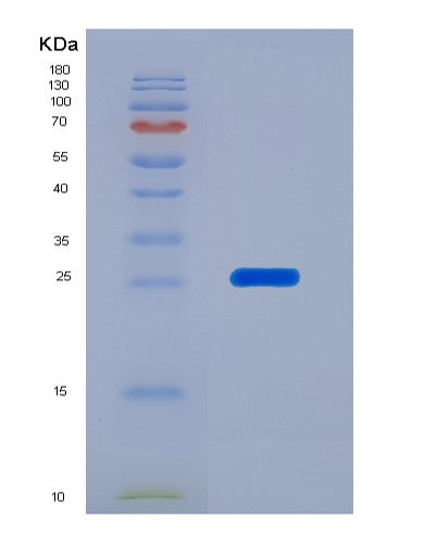 SDS-PAGE analysis of Human GSTT1 (Glutathione S-Transferase Theta-1) - Recombinant Protein, showing >85% purity under 15% SDS-PAGE (Reduced)