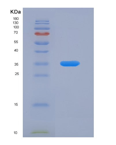 SDS-PAGE analysis of Human GDI1 (Rab Gdp Dissociation Inhibitor Alpha) - Recombinant Protein, showing >90% purity under 15% SDS-PAGE (Reduced)