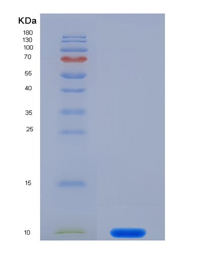 SDS-PAGE analysis of Human S100A7 (Protein S100-A7) - Recombinant Protein, showing >85% purity under 15% SDS-PAGE (Reduced)