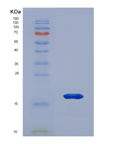 SDS-PAGE analysis of Human PRDX2 (Peroxiredoxin-2) - Recombinant Protein, showing >85% purity under 15% SDS-PAGE (Reduced)