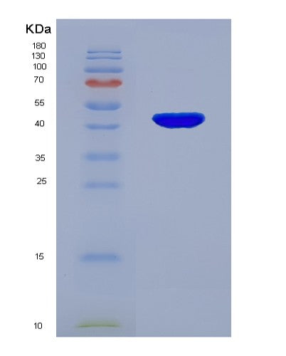 SDS-PAGE analysis of Human TNNC1 (Troponin C, Slow Skeletal And Cardiac Muscles) - Recombinant Protein, showing >90% purity under 15% SDS-PAGE (Reduced)